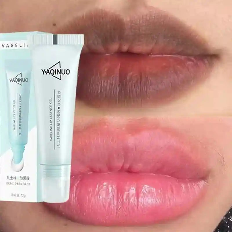 Lip Lightening Balm - Exfoliating Moisturizer for Dark Lips | Tidesmit Lip Care Tidesmit