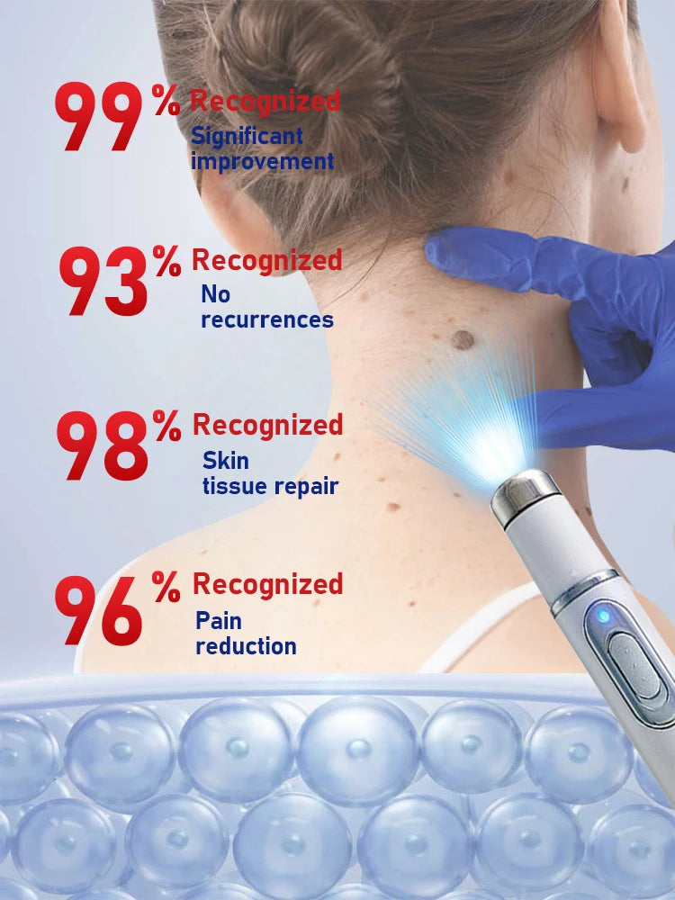 Wart Remover Serum - Fast Root Treatment for Professional PMU Artists Permanent Makeup Machines Tidesmit