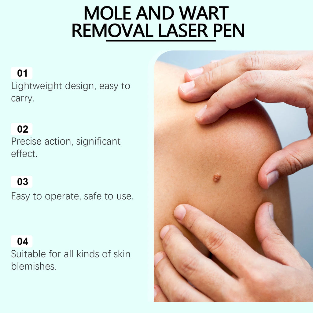 A mole and wart removal laser pen advertisement showing four product features next to a close-up of a skin blemish.