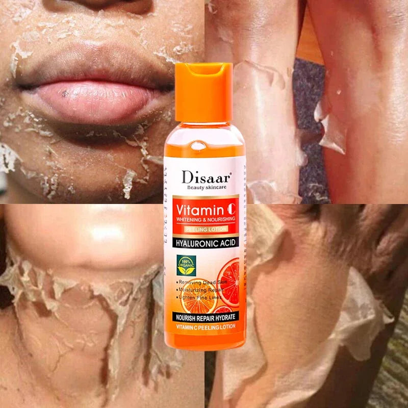 Yellow Peeling Oil for Dark Skin - Professional Exfoliating Treatment Scrubs Treatments Tidesmit