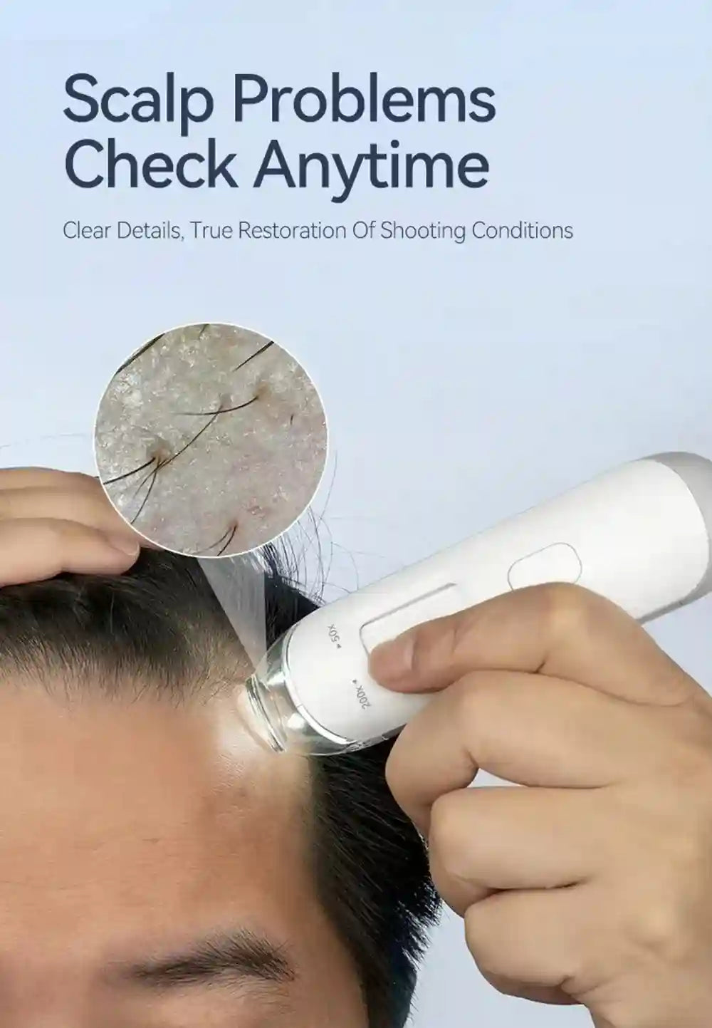 Handheld white digital scalp dermatoscope analyzer with 50X and 200X zoom lenses for hair and skin diagnostic testing.