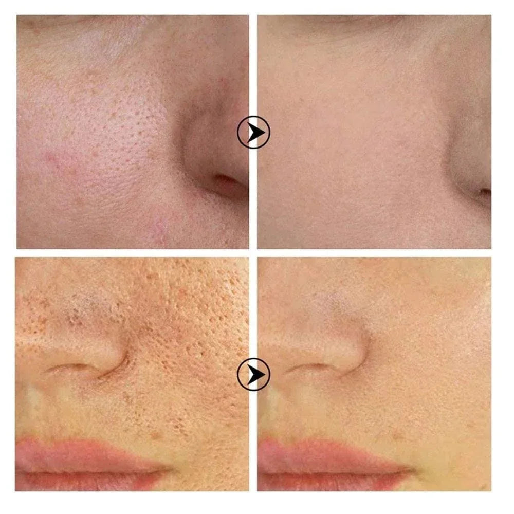 Retinol Niacinamide Serum - Professional PMU Machine Pore Refining Permanent Makeup Machines Tidesmit