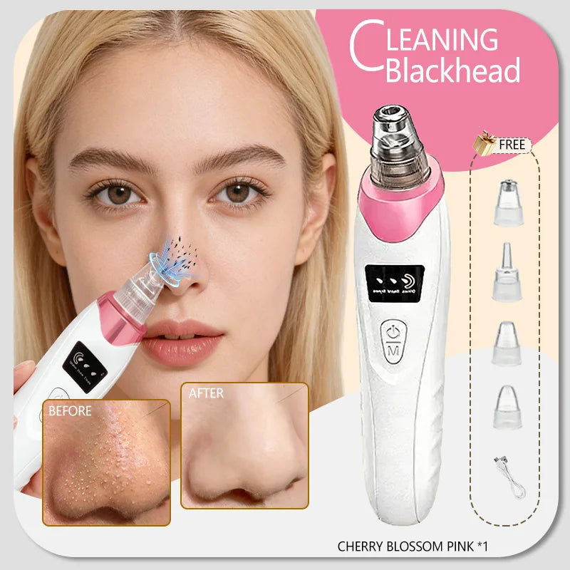 Electric blackhead remover vacuum pore cleaner with 4 suction heads for acne and facial skin pore cleansing.