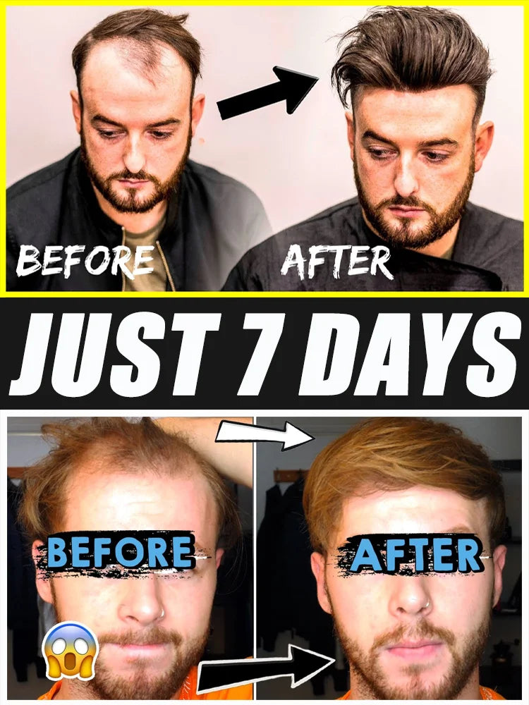 Hair Growth Serum for Follicle Stimulation & Thicker Strands Relaxation Treatment Pack of 1Pcs Tidesmit