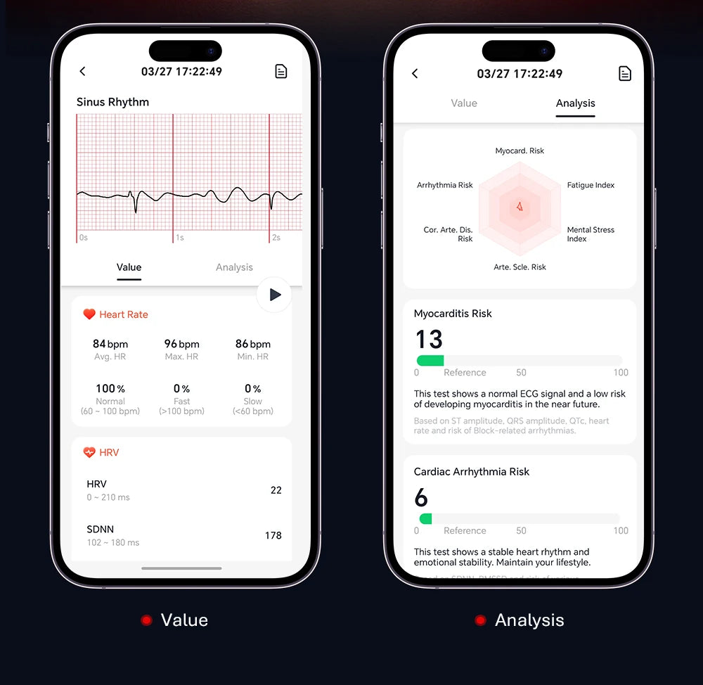 VALDUS VANTA ECG Smartwatch Man Woman SOS Fall Reminder Fitness Tracker Heart Rate Blood Pressue Sleep Monitor 2026 New Bracelet