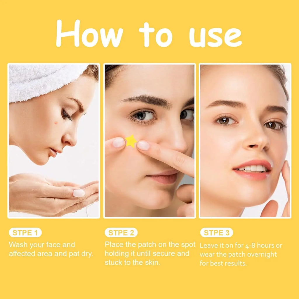 60 pieces/premium mirror acne patch, covering acne and pimple patches, deep cleansing patch, gentle and skin friendly