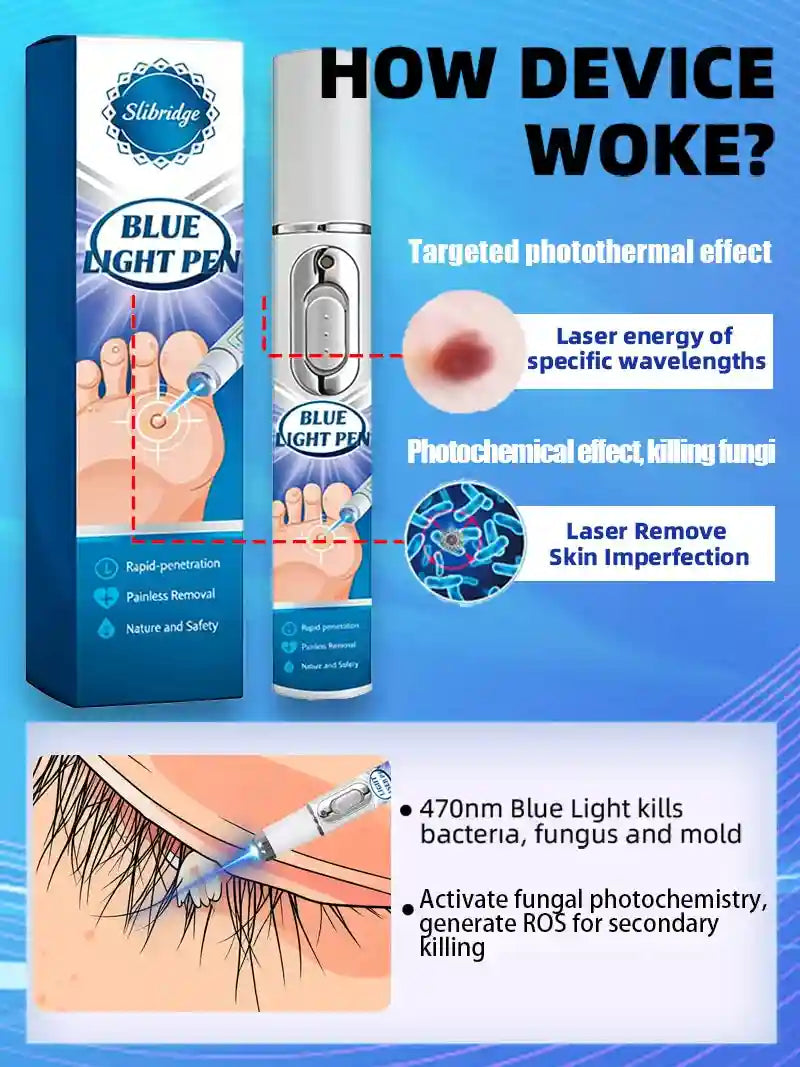 Blue Light Pen for Wart Removal – Certified Skin Care Tool Lip Care Tidesmit