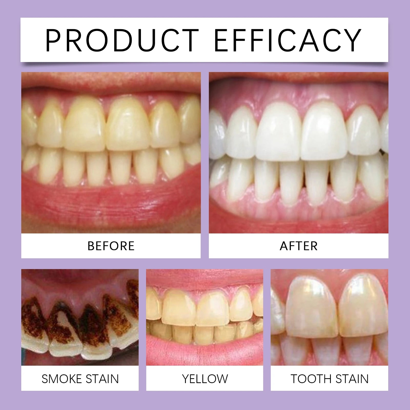 Tidesmit teeth restoration mineral powder for professional teeth whitening, stain removal, and fresh breath