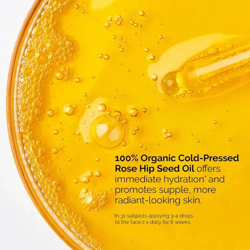 100% Organic Cold-Pressed Rose Hip Seed Oil 30ml Serum Facial Soothing Properties Remove Dull Acne Marks  and Brighten The Skin