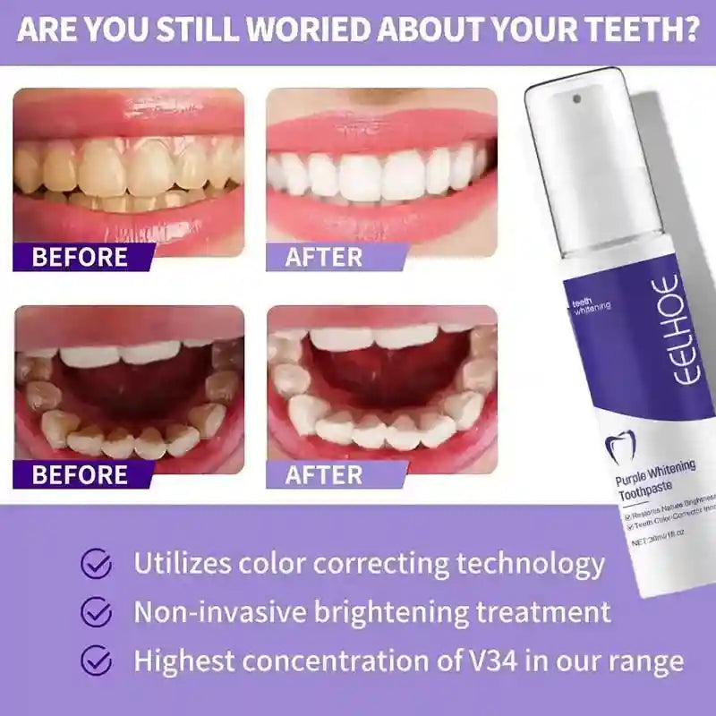 Tidesmit 2026 teeth whitening toothpaste for effective yellow stain removal and daily oral hygiene care