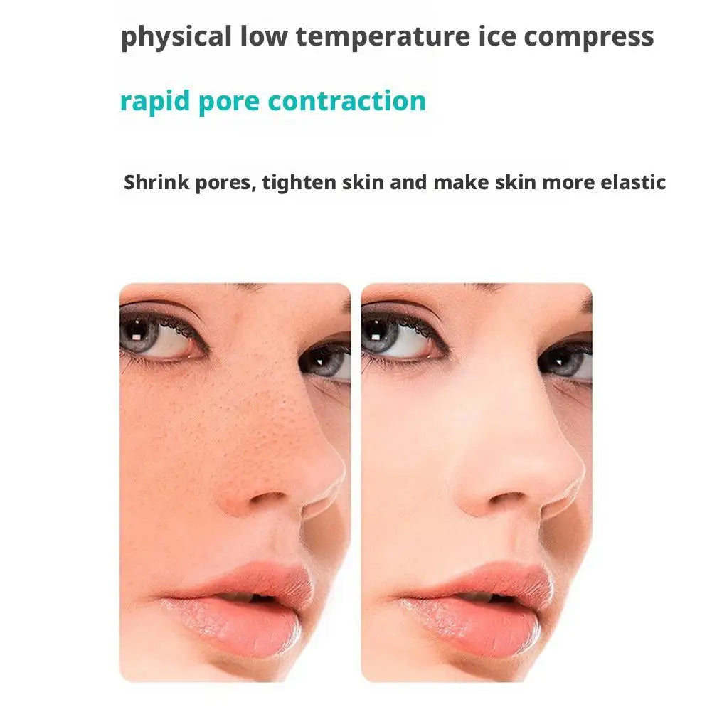 Before and after comparison of a person's nose and cheek, showing reduced pore size after ice facial treatment.