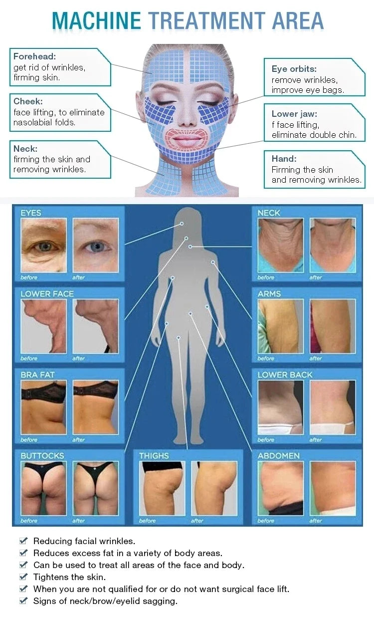 Professional Skin Tightening Machine for Face Lifting and Fat Removal Relaxation Treatment Tidesmit