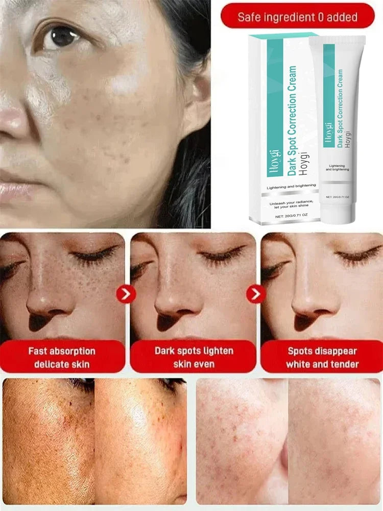Dark Spot Corrector Cream for Pigmentation & PMU Aftercare | Tidesmit Permanent Makeup Machines Tidesmit