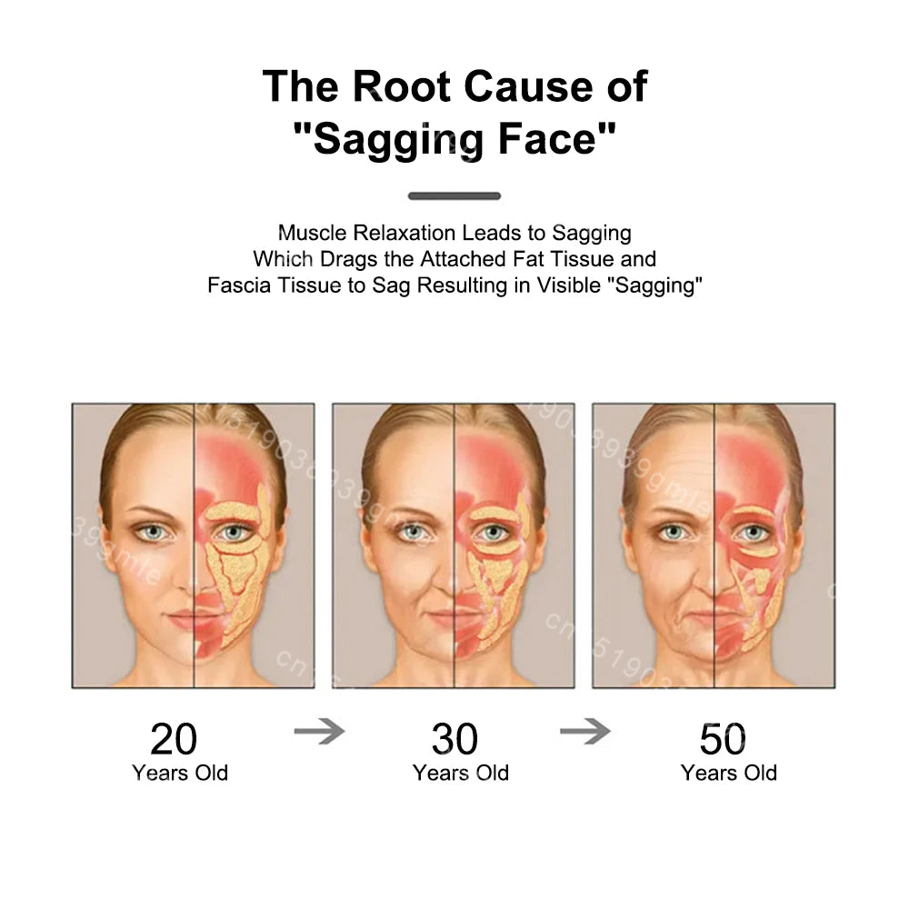Diagram showing face anatomy changes in women at ages 20, 30, and 50 to illustrate the cause of facial sagging.