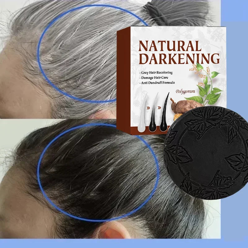 White hair killer, polygonum multiflorum shampoo soap，remove gray hair and restore natural hair color in 7 days
