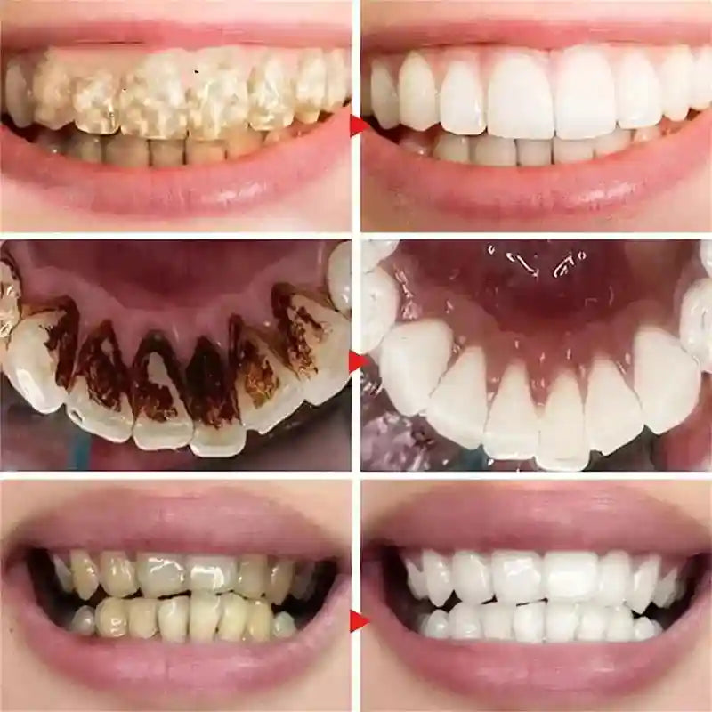 Tidesmit 2026 whitening toothpaste for effective yellow teeth removal and daily oral hygiene teeth cleaning