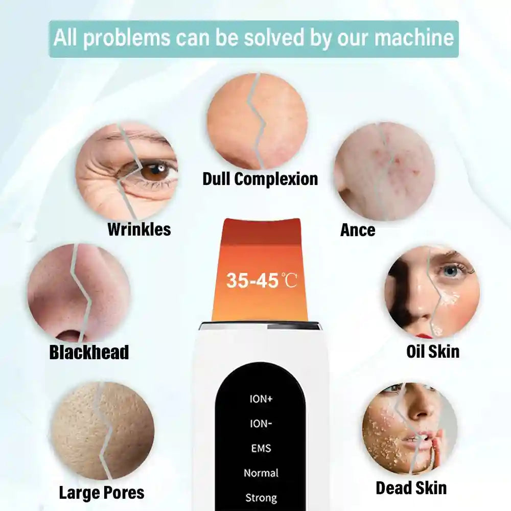 Ultrasonic Skin Scrubber | Professional Facial Cleansing Tool Scrubs Treatments Tidesmit