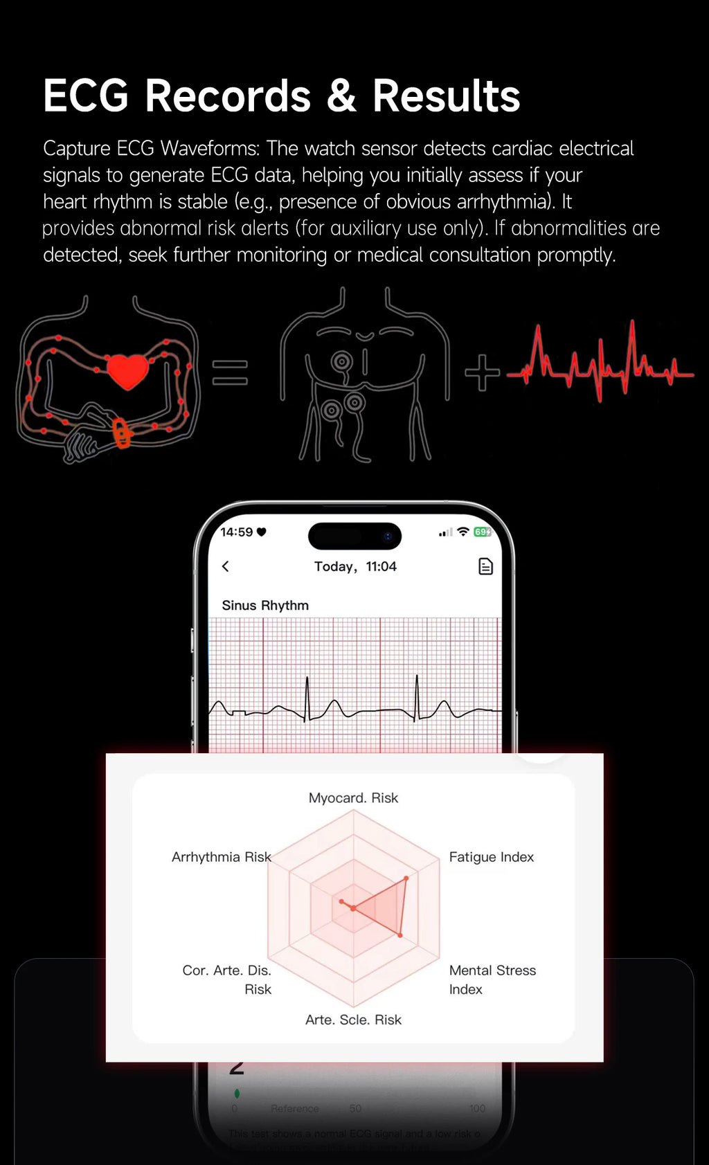 LIGE New ECG+PPG Smart Bracelet Heart Rate Health Monitoring Thermometer HPV Test Reports Waterproof Sports Tracker Smart Watch
