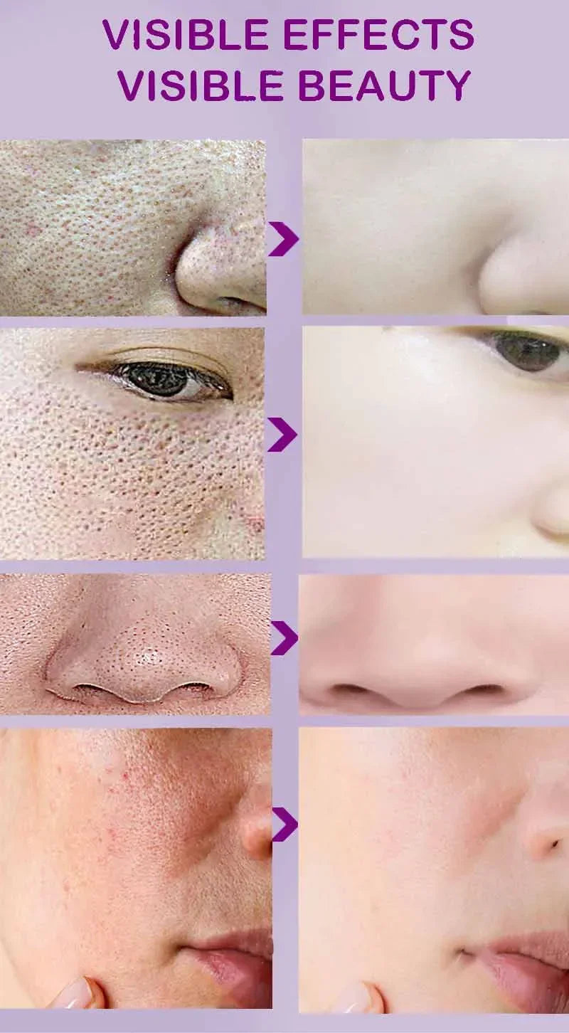 Retinol Niacinamide Serum - Professional PMU Machine Pore Refining Permanent Makeup Machines Tidesmit