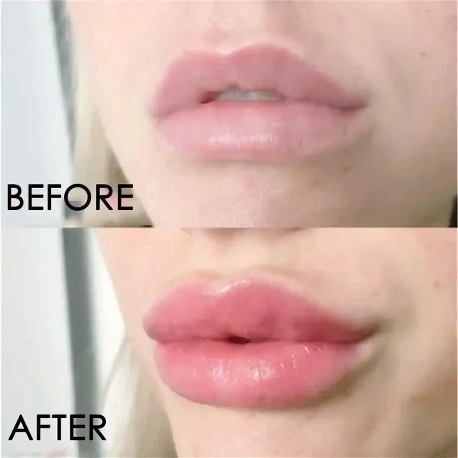 Lip Plumper Oil: Instant Volumizing Serum for Hydrated, Fuller Lips Lip Care Tidesmit