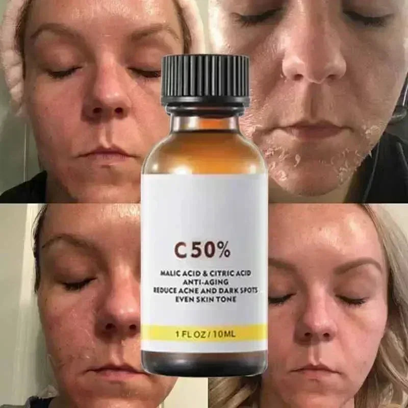 Salicylic Acid Face Peel - Professional Deep Exfoliation & Skin Refinement Scrubs Treatments Tidesmit