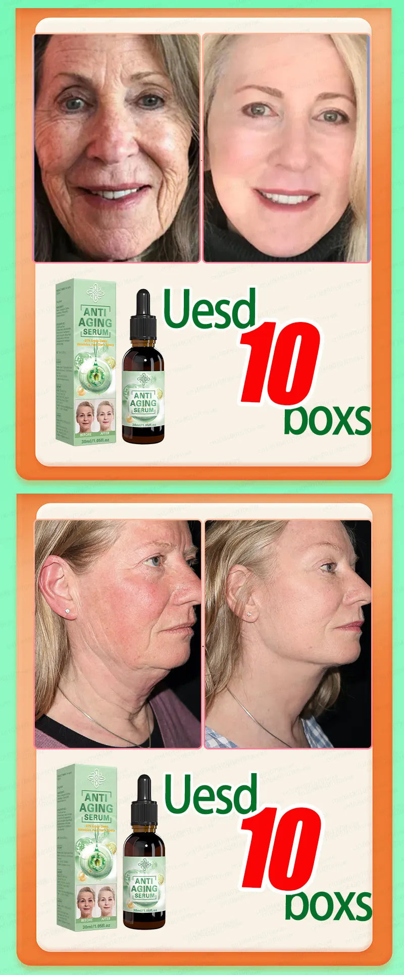 Tidesmit anti-aging serum for wrinkle removal and skin tightening before and after results.