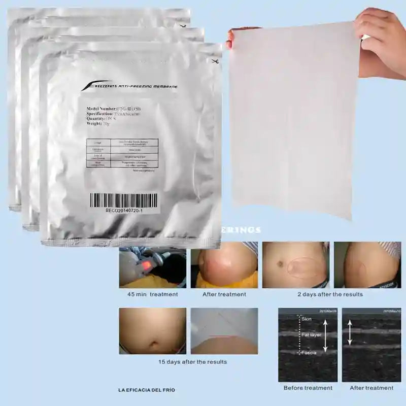 Cryotherapy Fat Freezing Membrane Pads for Professional Cool Sculpting Eye Massage Instrument Tidesmit