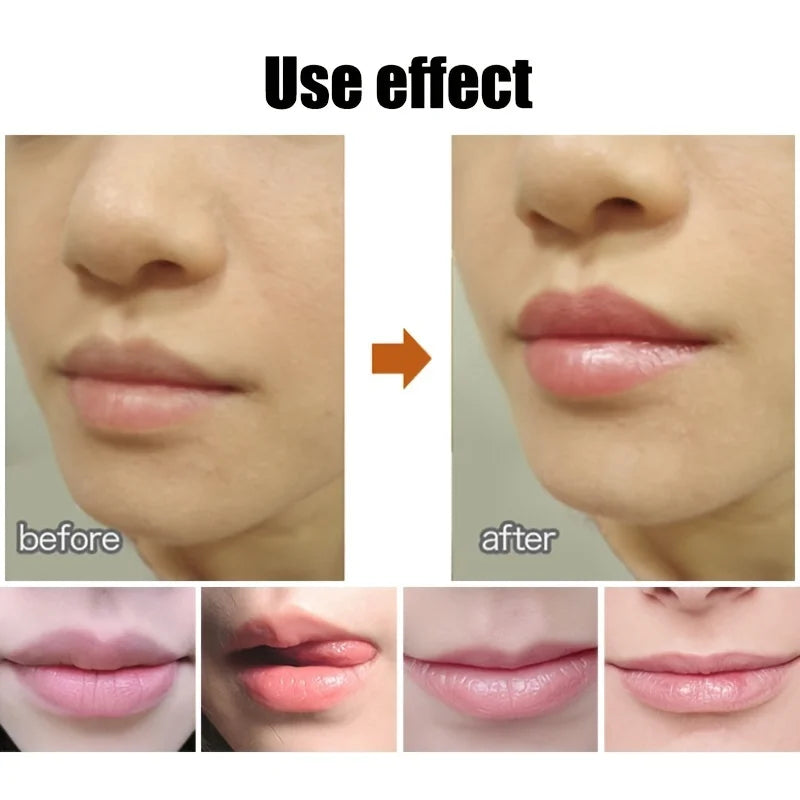 Ball Shaped Hydrating Lip Balm Set - 6pcs Nourishing Lip Care Lip Care Tidesmit