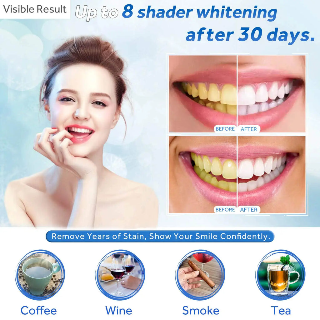 Tidesmit dental grade teeth whitening gel refill syringe for Invisalign style whitening trays