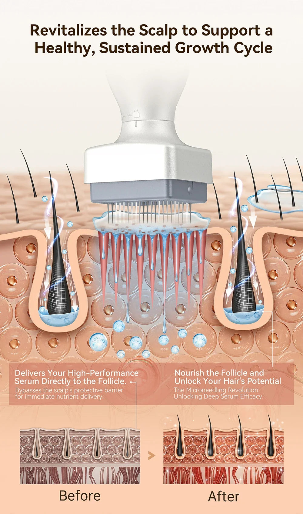 Adjustable microneedling derma stamp pen delivering serum to hair follicles for scalp and beard growth treatment.