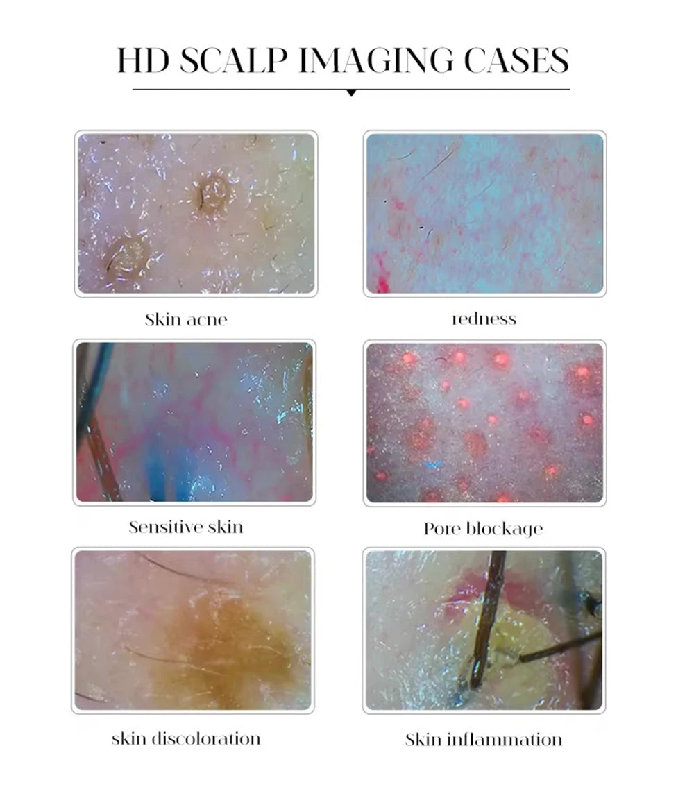 Six HD scalp images showing skin conditions: acne, redness, sensitivity, pore blockage, discoloration, and inflammation.