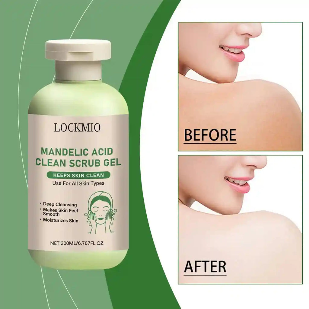 Mandelic Acid Exfoliating Scrub Gel | Professional Skin Smoothing 200ml Scrubs Treatments Tidesmit