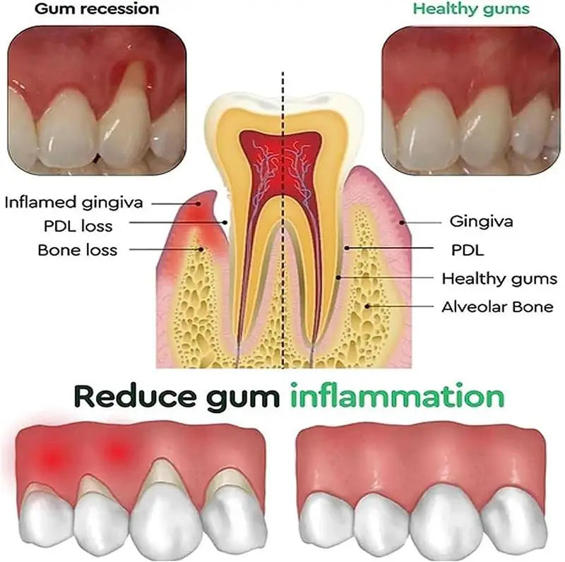 Tidesmit Rapid Soothing Gums Serum for tooth sensitivity, dental caries relief, and professional teeth whitening