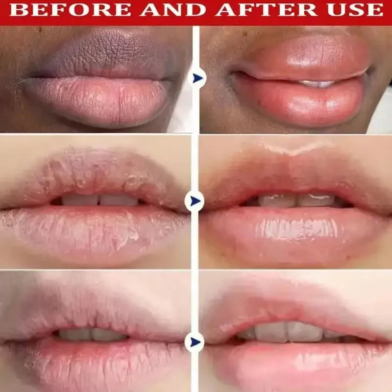 Dark Lip Lightening Balm – Exfoliating Lip Care Treatment by Tidesmit Lip Care Tidesmit