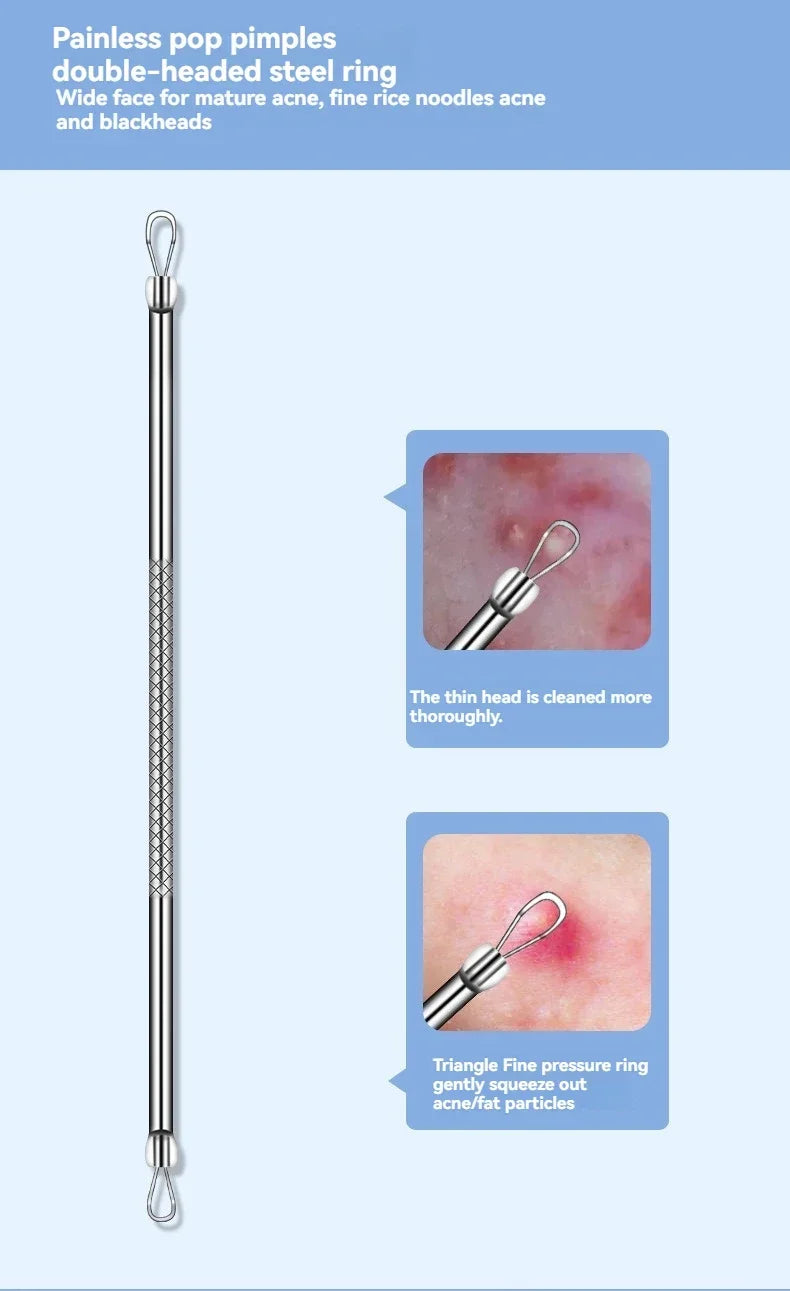 Double-ended stainless steel acne removal tool with a textured grip and different wire loops for extracting blemishes.