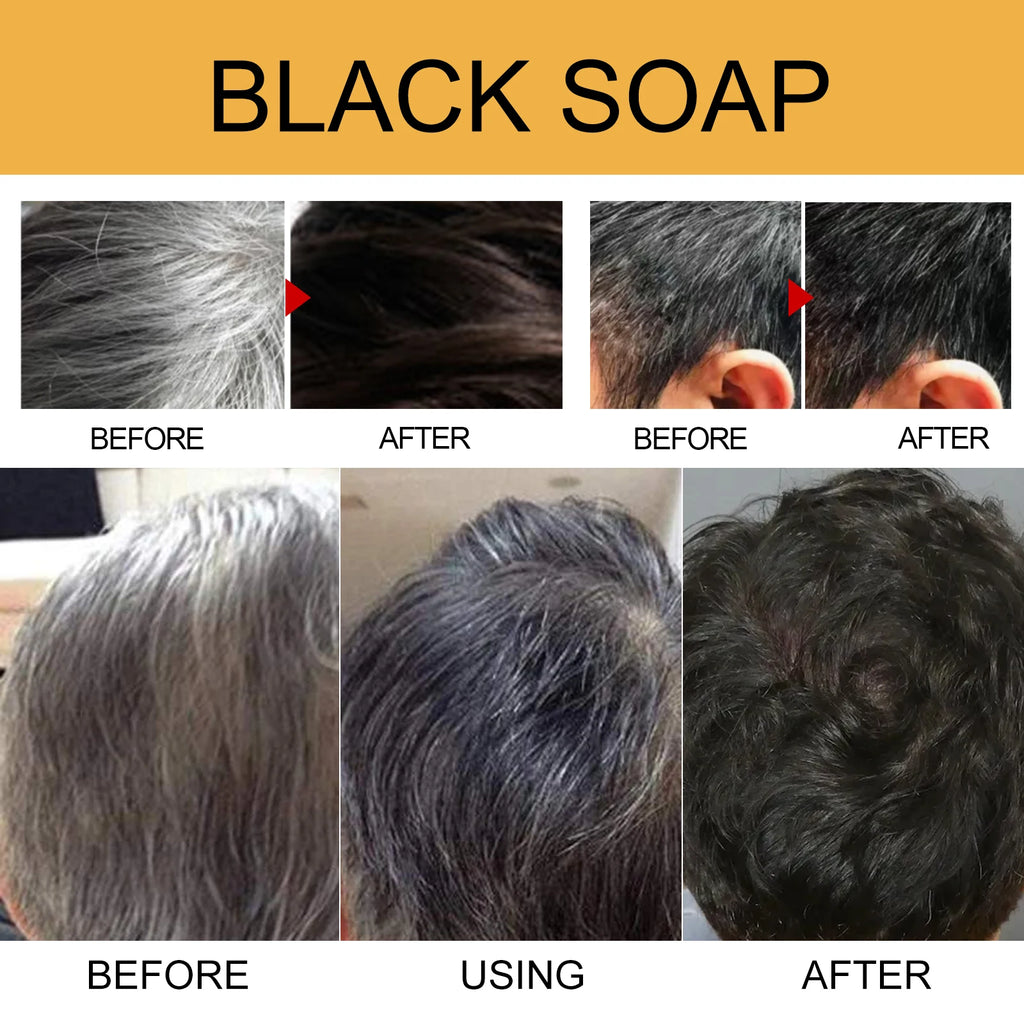 Gray Hair Shampoo Bar Turn Black Improve Dull & White Hair Anti-Dandruff Nourish Scalp  Polygonum Multiflorum Biotin Soap