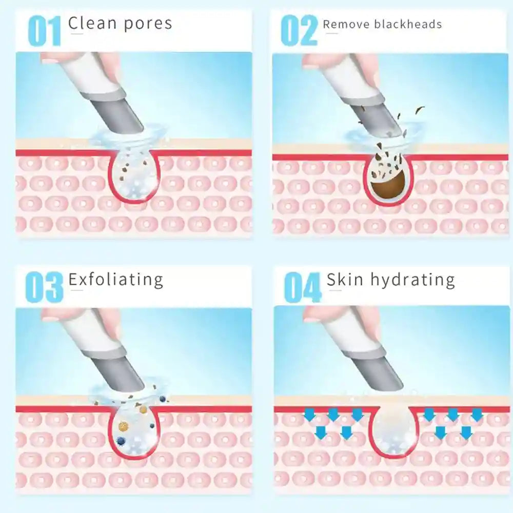 Hydra Facial Machine - Deep Pore Cleansing & Electric Massager Tool Eye Massage Instrument Tidesmit