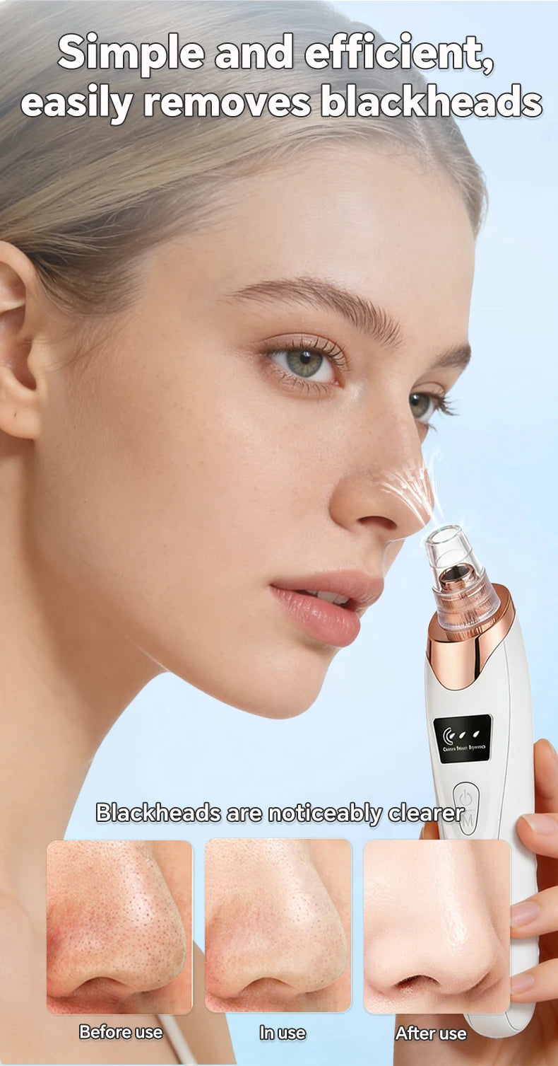 Electric blackhead vacuum remover tool cleaning pores on nose with before and after skin improvement results.