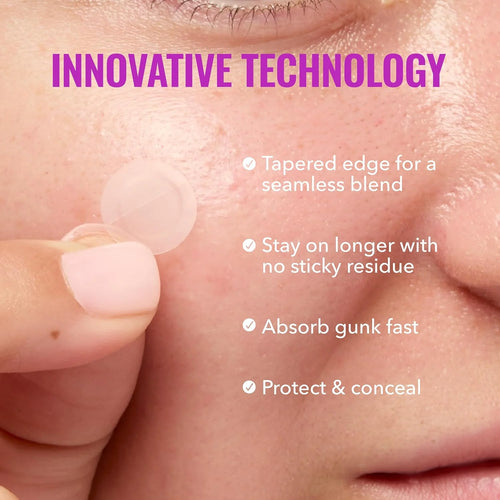 Clear hydrocolloid acne patch on skin, held by a fingertip