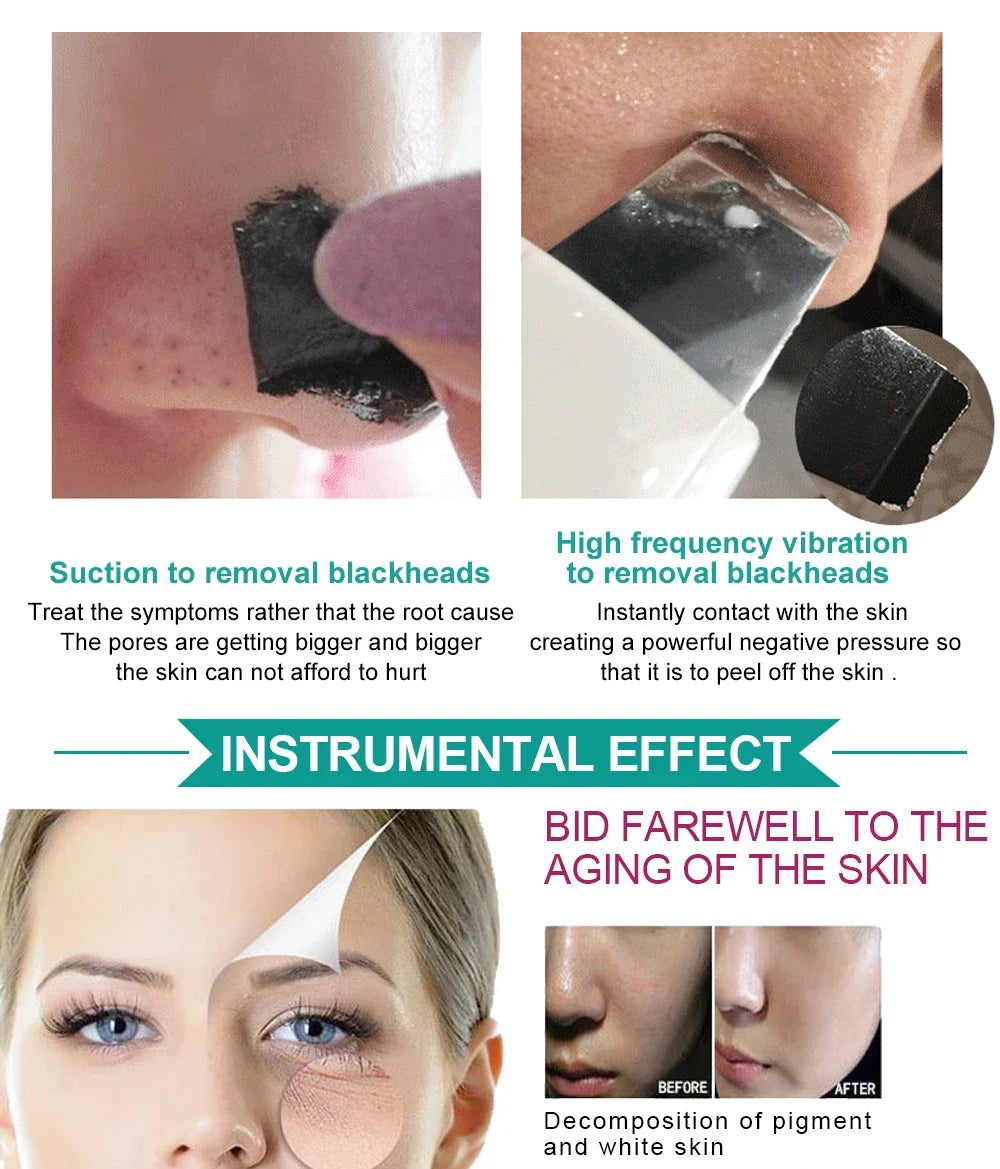 Ultrasonic Skin Scrubber | Deep Pore Cleanser & Acne Removal Tool Scrubs Treatments Tidesmit