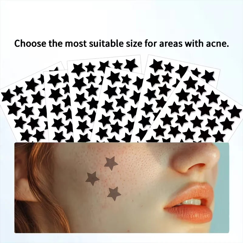 Tidesmit star-patterned acne patches for men and women, 200-400 count box for effective blemish treatment.