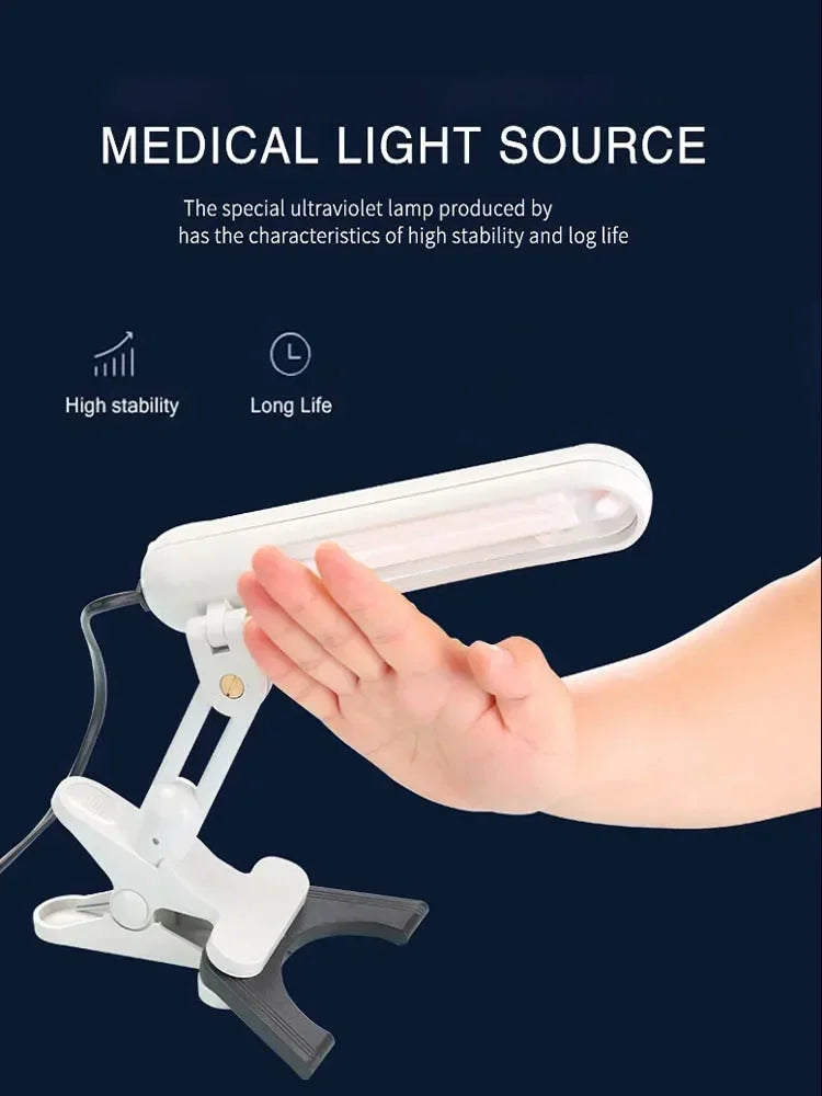 Portable 311nm handheld UVB lamp for vitiligo, psoriasis, and eczema treatment with a stable, clip-on medical light.