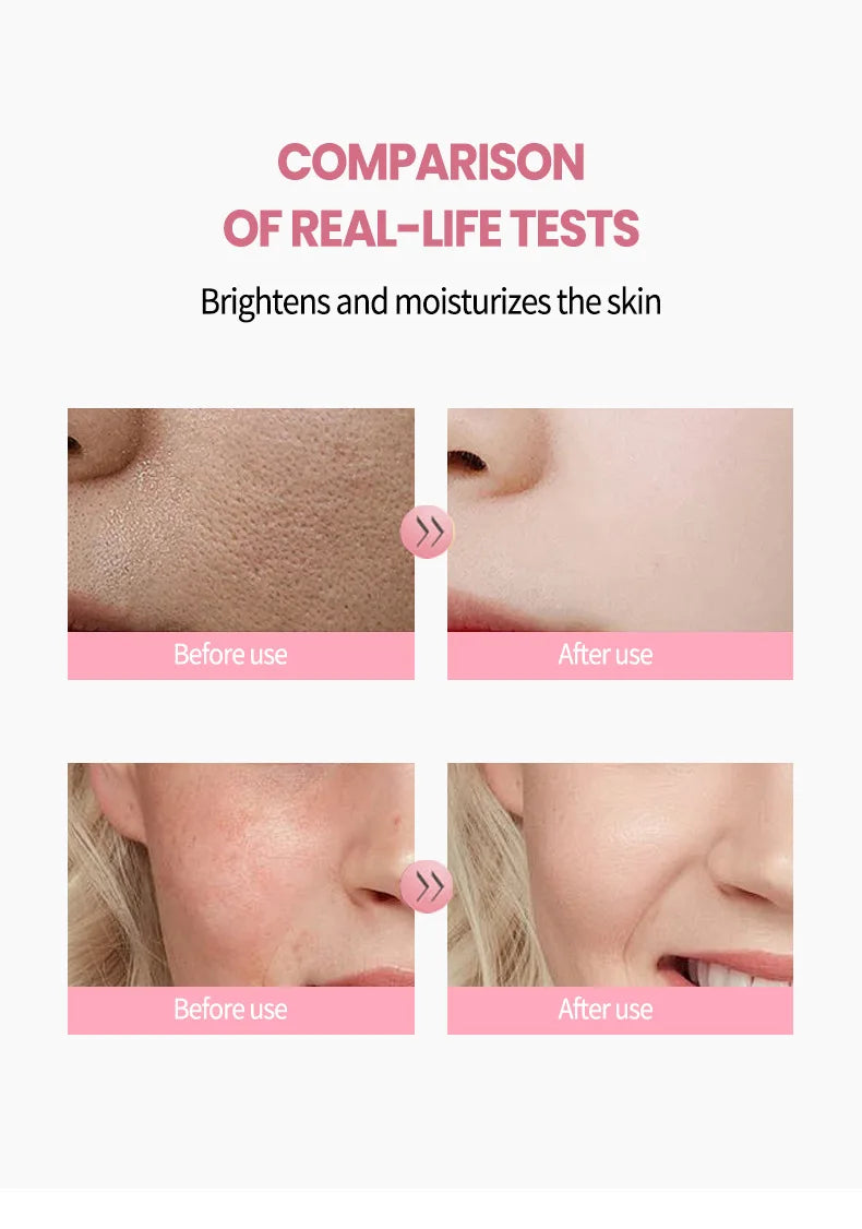 Before-and-after comparison showing skin brightening and smoothing after using Korean Pink Collagen PDRN Capsule Cream.