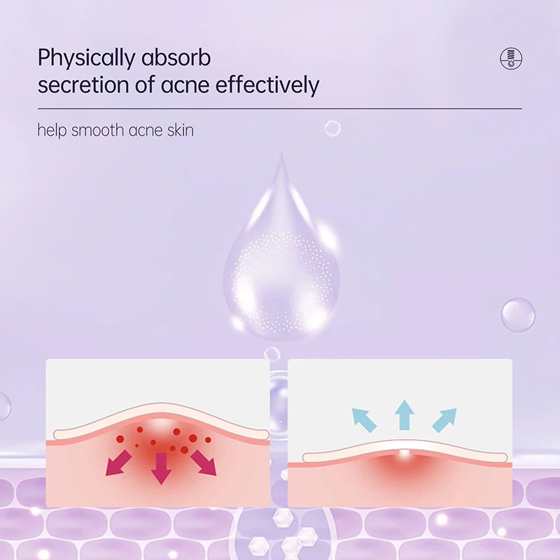 36pcs Hydrocolloid Acne Patches Absorb Pus & Oil, Reduce Redness, Invisible Fit for All-Day Wear Spot Stickers for Face and Body