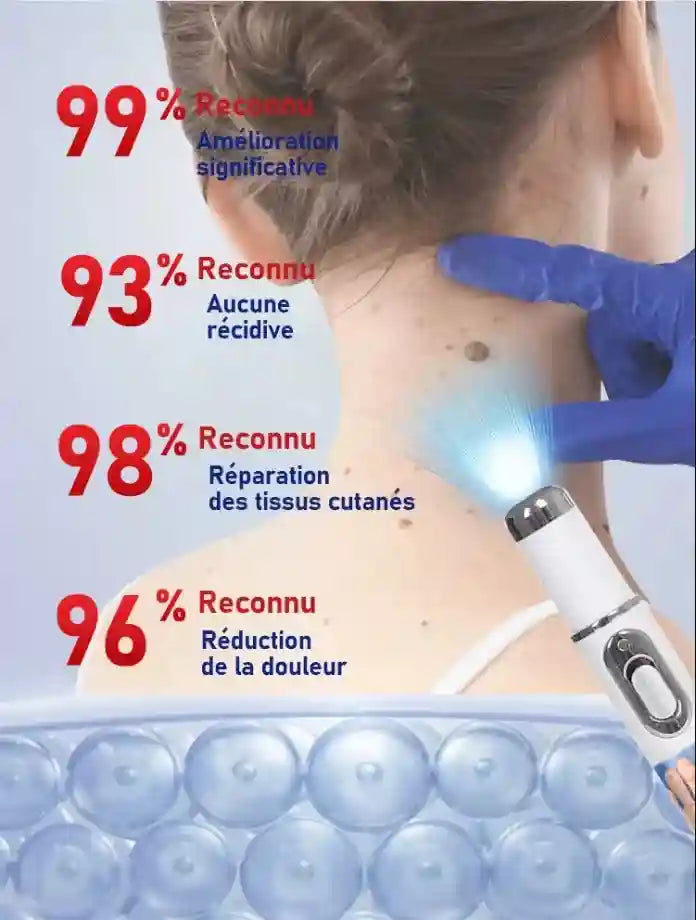 Blue Light Wart Removal Pen - Painless Portable Skin Tag Tool Massage Roller Tidesmit