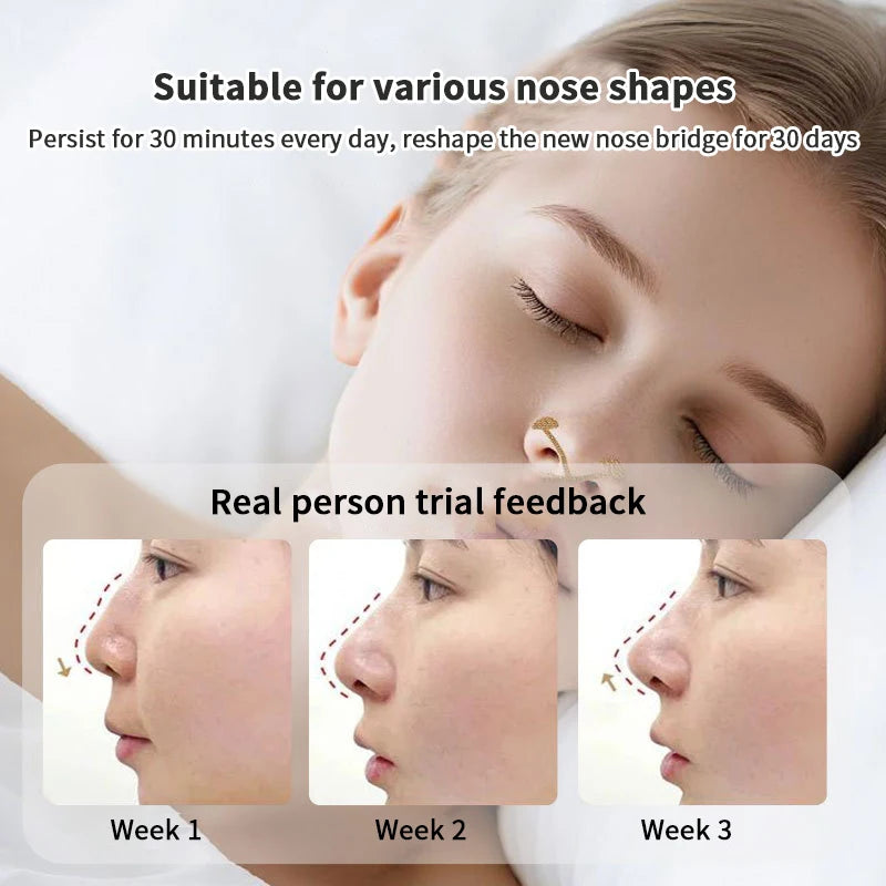 Invisible nose wing shrinking stickers and lifting patch for face shaping and nose bridge correction, weekly progress.
