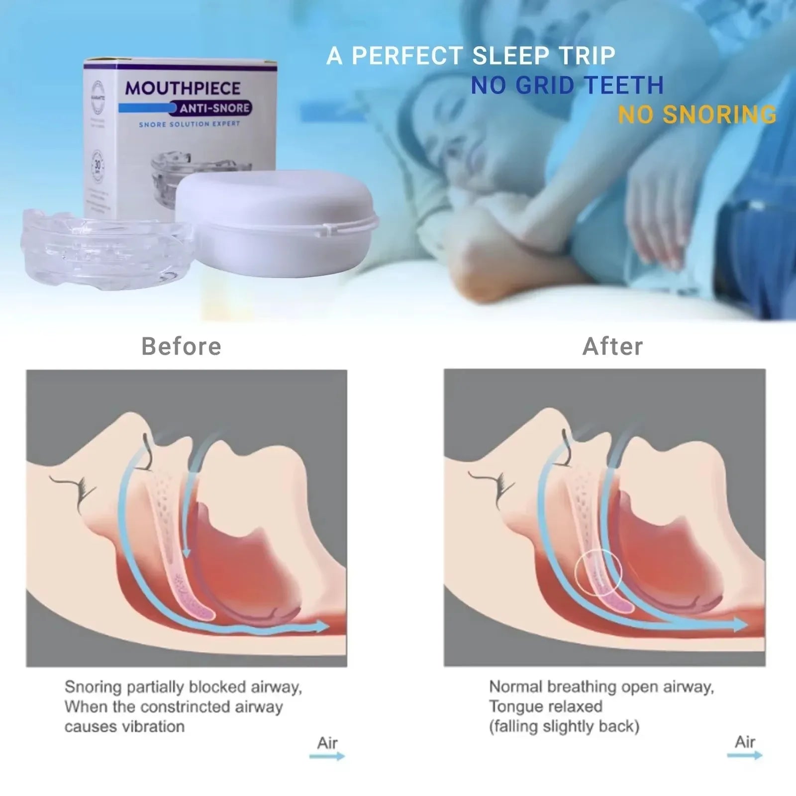 Anti-Snoring Teeth Bruxism Mouthguard - Sleep Improvement Device for Snoring And Apnea - Pack of 1/2/3/4/5 Pcs