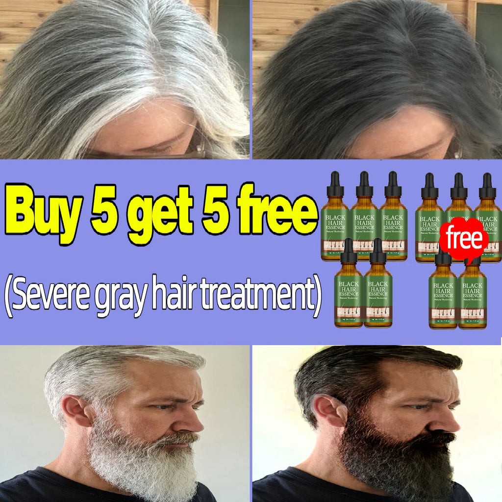 Anti Gray Hair Serum – Natural Scalp Nourishing Darkening Care Lip Care 10 pcs Tidesmit