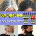 Anti Gray Hair Serum – Natural Scalp Nourishing Darkening Care Lip Care 10 pcs Tidesmit