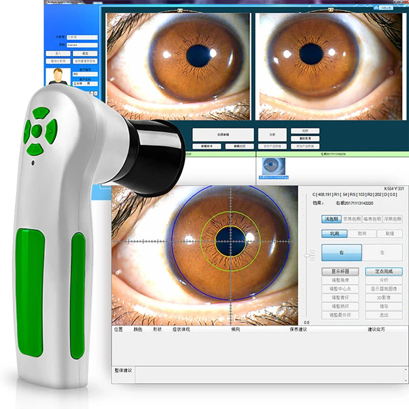 Iridology Digital Camera 12MP Professional Iris Scanner Analyzer Body Shaping Massage Equipment Tidesmit